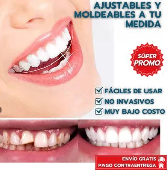 CARILLAS DENTALES 😁✨ SONRISA PERFECTA AL INSTANTE🦷💫