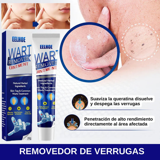 CREMA REMOVEDORA DE VERRUGAS - SUMIFUN 100% ORIGINAL
